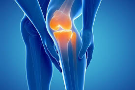 Are Collagen Supplements Helpful for Arthritis?